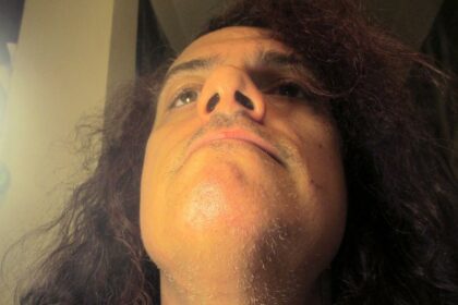 Post-Laser Hair Removal: Is Shaving Still Necessary? 6 Post-Laser Hair Removal: Is Shaving Still Necessary?