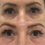 Laser Smooth: Exploring the World of Hair-Free Enthusiasts