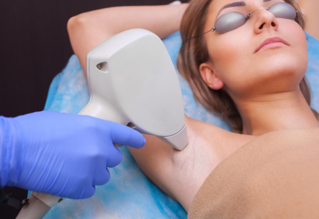 Unlock Smooth Skin: The Magic of Permanent Laser Hair Removal