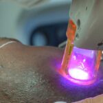2024’s Ultimate Laser Hair Removal Cost Guide Revealed!