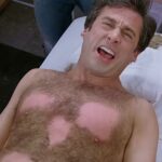 Nixing Nipple Hairs: Laser Side Effects Unveiled!