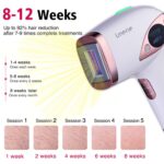 Smooth Sailing: Your Guide to At-Home Laser Hair Removal
