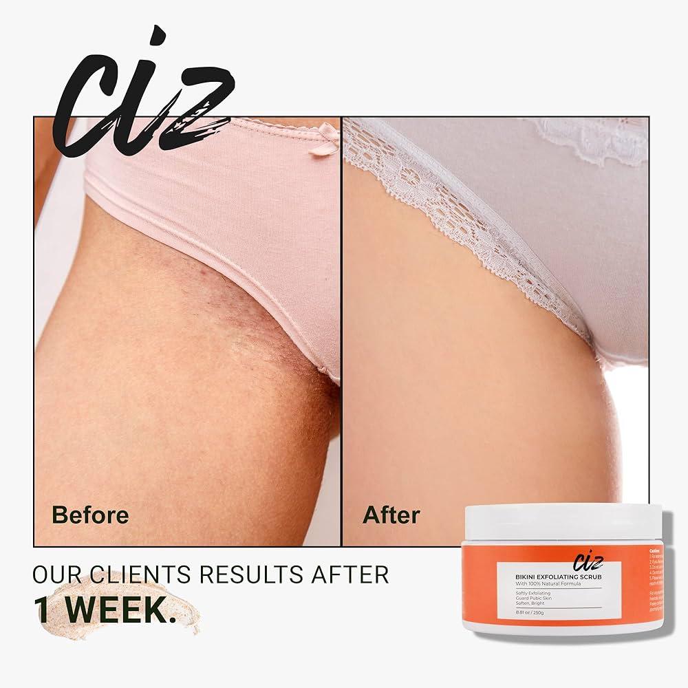 Bikini Area Laser Hair Removal: Worth the Buzz?