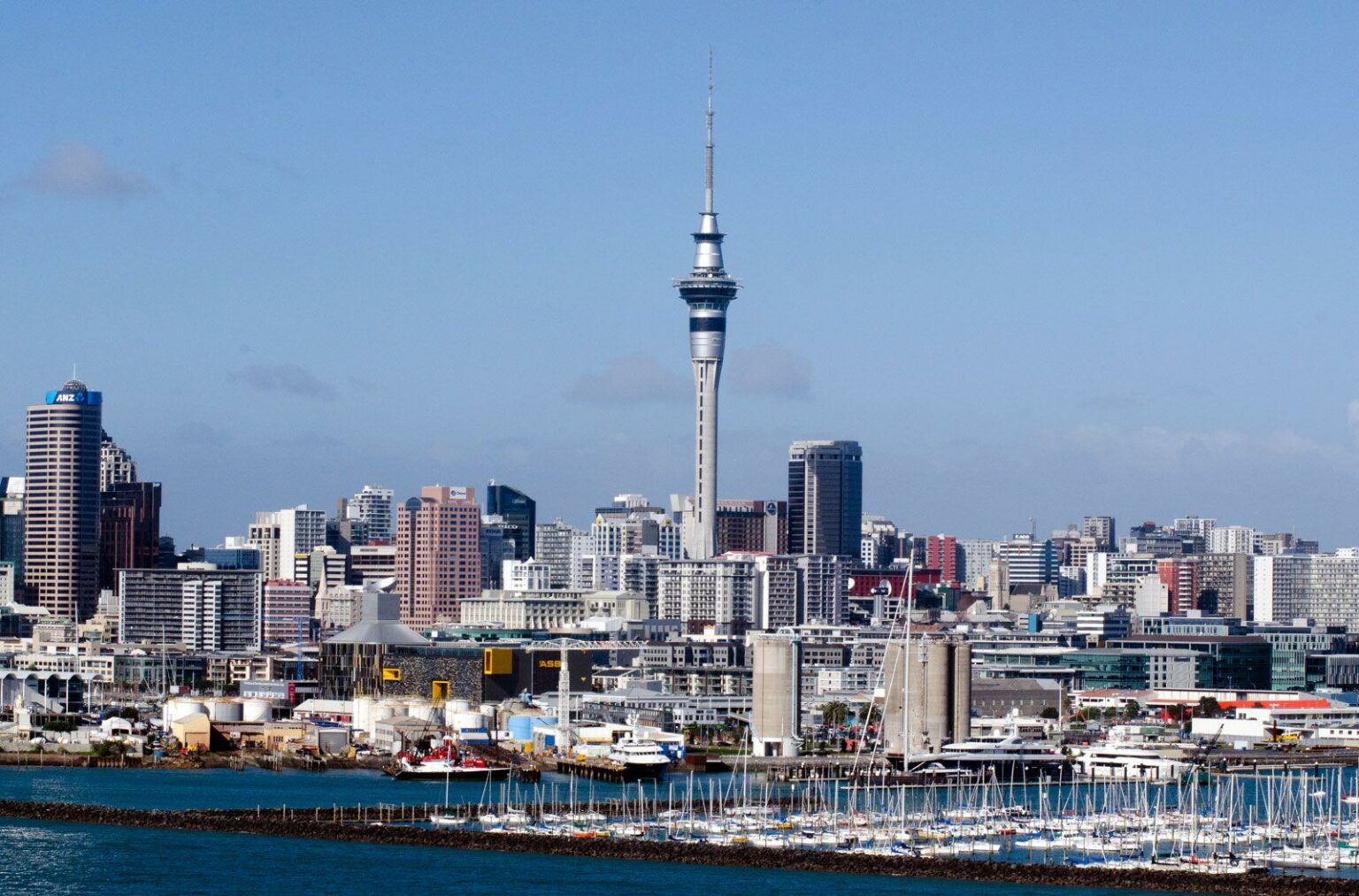 Zap and Shine: Auckland’s Top Laser Hair Removal Reviewed