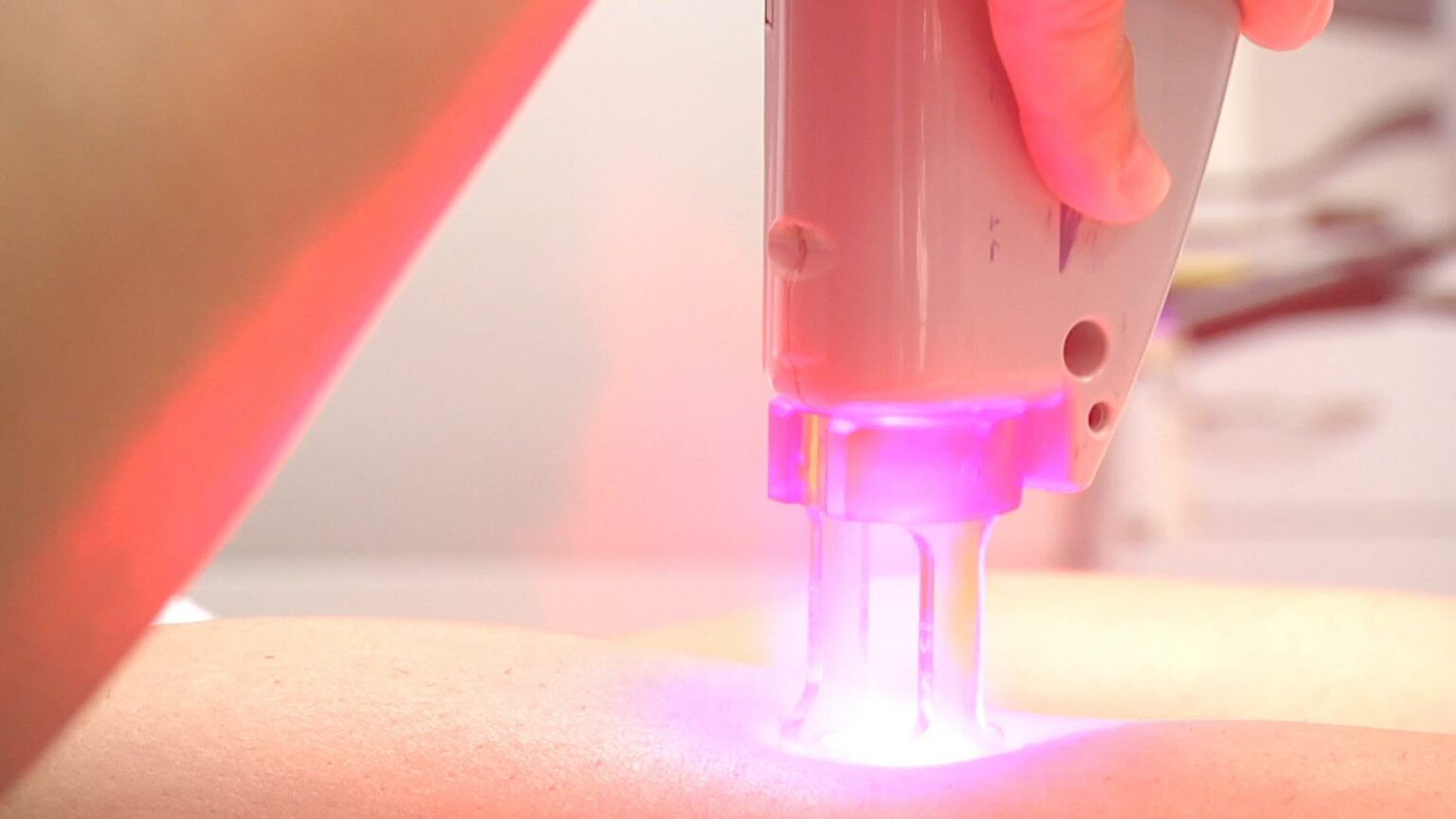 Effortless Smooth: Laser Hair Removal Machines Pro Review