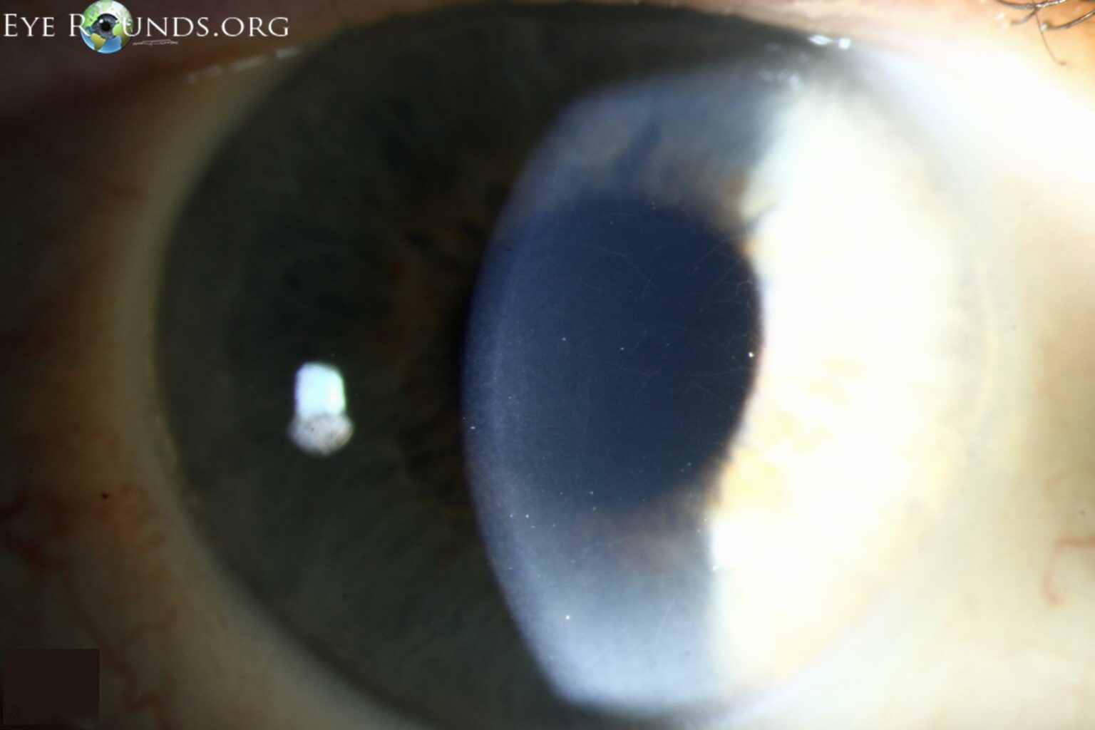 Discovering the Hidden Pathways of Your Corneal Nerves!