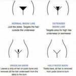 Smooth Transitions: Pubic Laser Hair Removal Unveiled