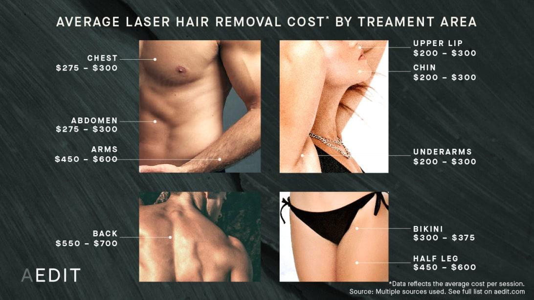 Say Goodbye to Razors: Full Body Laser Hair Costs Explained