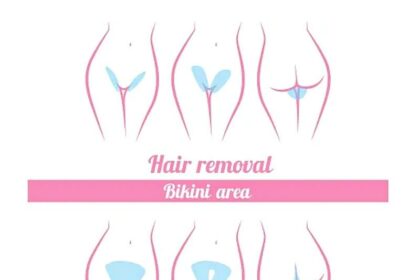 Smooth Costs: Bikini Laser Hair Removal Price Guide