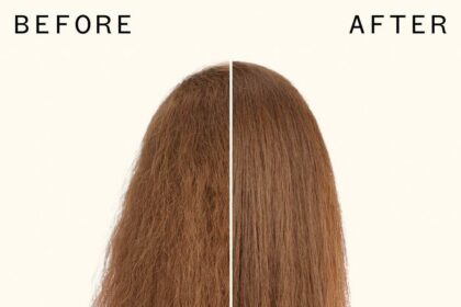 Achieve Silky Smooth: Pro OPT Elight IPL’s Magic Touch