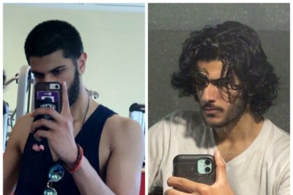 Shedding Light: Your Hair Growth Journey Post-Laser