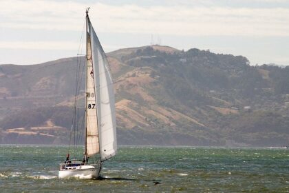 Smooth Sailing: Mismon MS-206B Laser Hair Removal Device