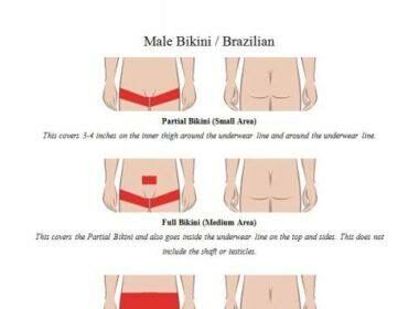 Is Brazilian Laser Hair Removal Safe? What to Know!