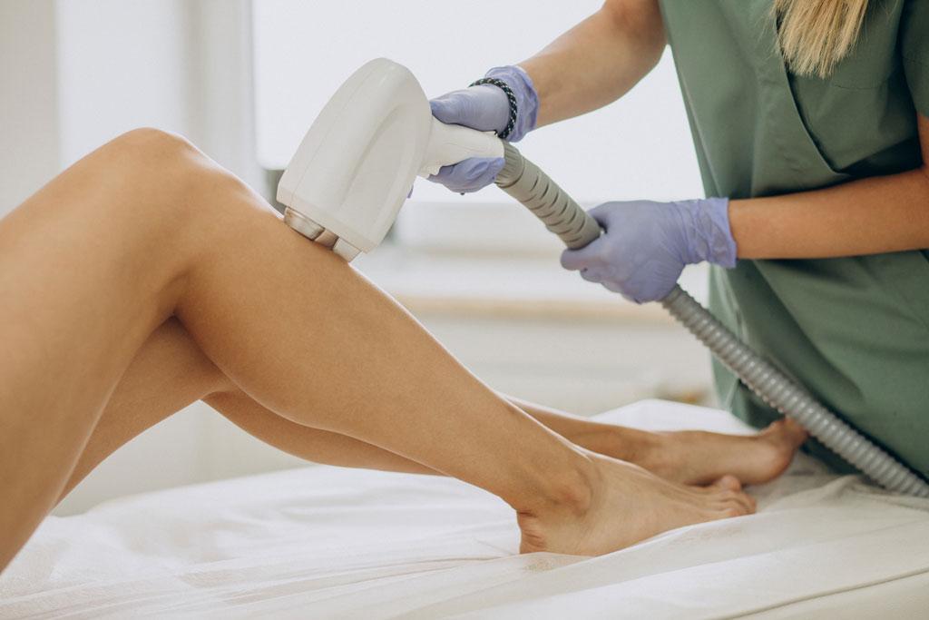 Smooth Sailing: The Lasting Impact of Leg Laser Hair Removal