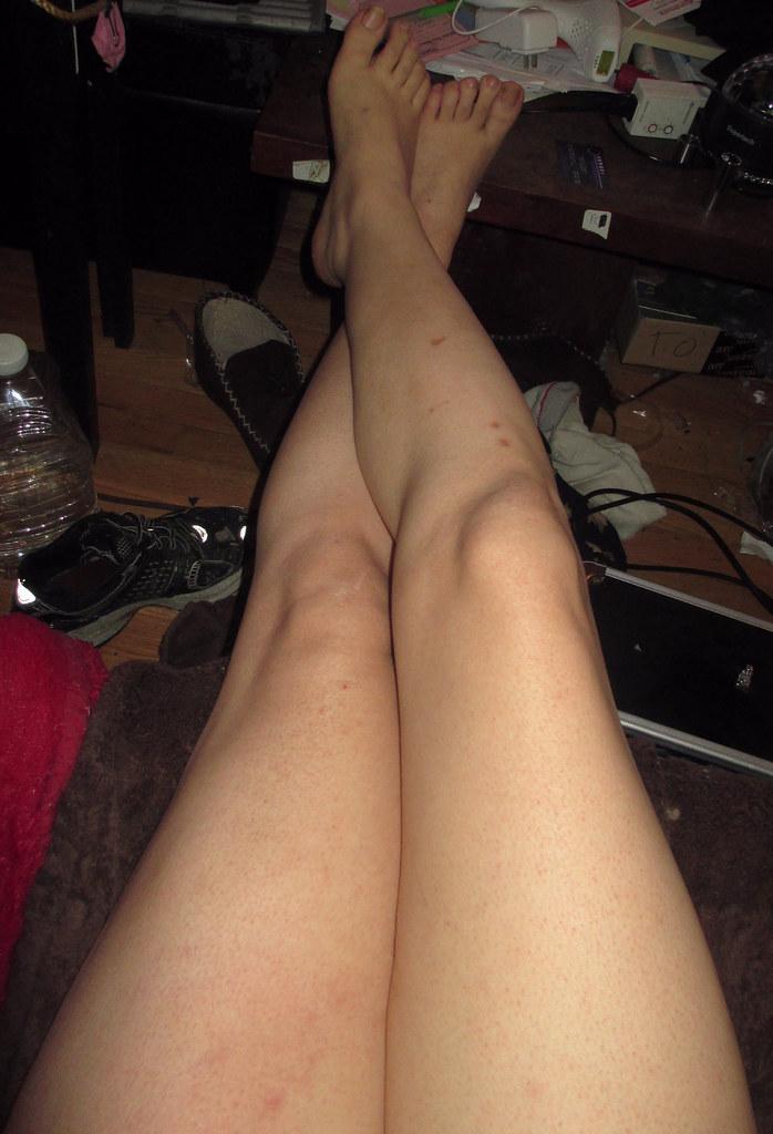 Smooth and Radiant: Your Guide to Laser Leg Transformation