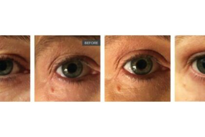 Laser Smooth: Adelaide’s Top Hair Removal Reviews