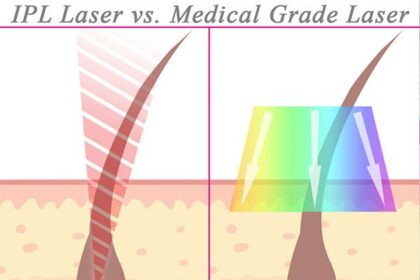 Top Medical-Grade Lasers for Swift, Smooth Hair Removal 18 Top Medical-Grade Lasers for Swift, Smooth Hair Removal