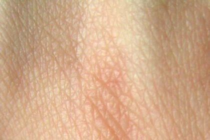 Skin, Hair, & Nails: Your Child's Natural Armor Guide 12 Skin, Hair, & Nails: Your Child’s Natural Armor Guide