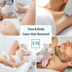 Top Laser Hair Removal Machines Perfect for Black Skin