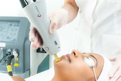 Discover Smooth Skin: Candela Laser Hair Removal Success!