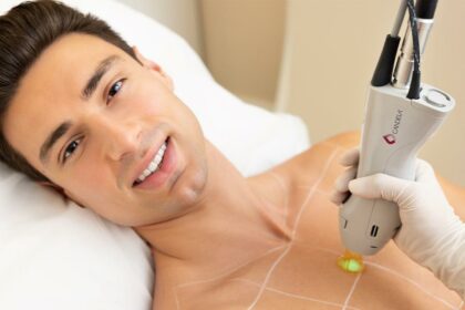 Smooth Sailing: Discover Candela Laser Hair Benefits!
