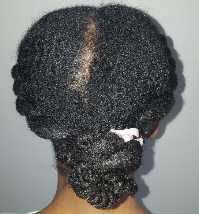 Understanding Coarse Hair: Why Laser Treatments Work Better