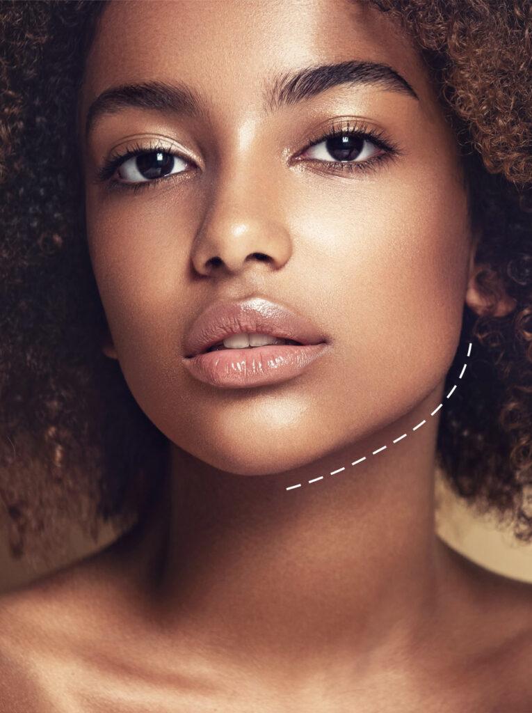 The Price of a Smooth Jawline: What You Need to Know