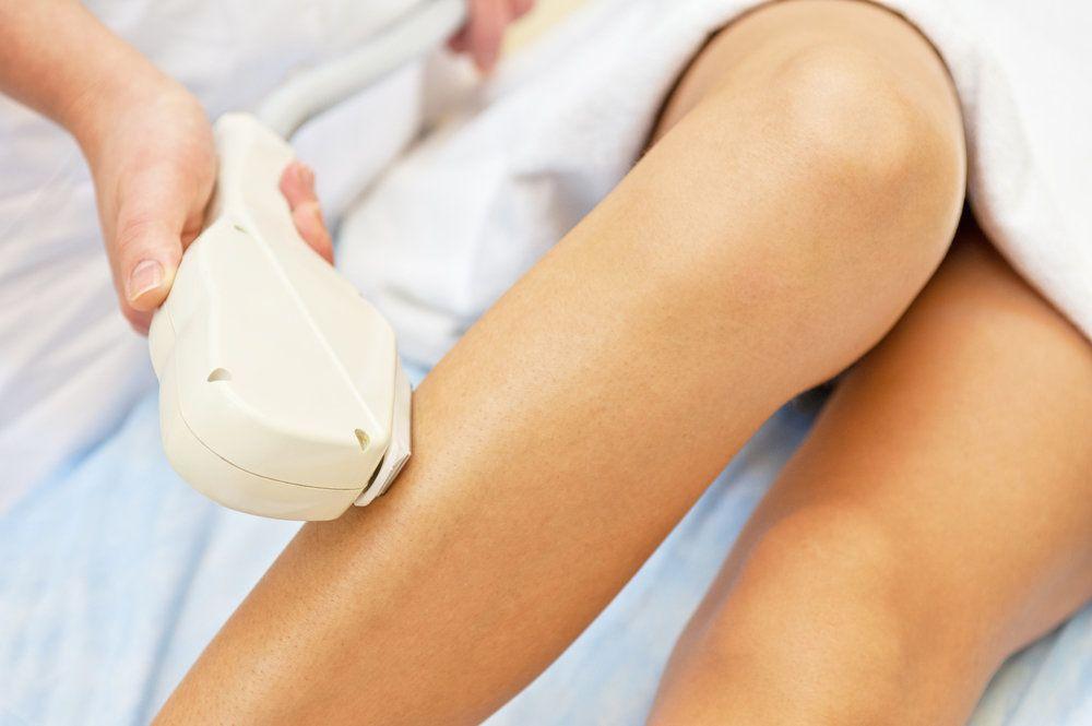 What to Expect During Your First Laser Session