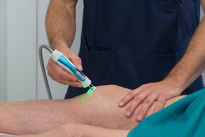 Understanding the Chill:‌ What‌ Cold Laser Therapy Actually ⁣Does