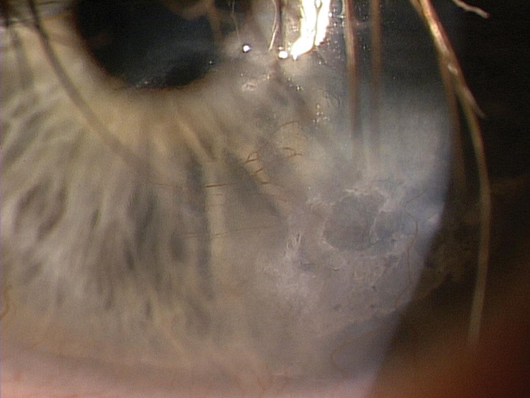 How Your Corneal Nerves Impact Vision and Health