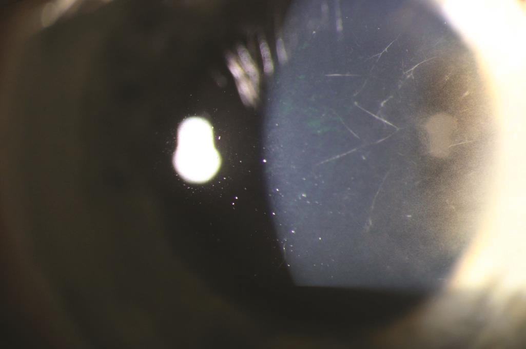 Practical ‍Tips for Strengthening⁣ Corneal⁤ Nerve Health