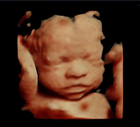 Tria Laser Hair Removal: My Journey Begins! Part 1 4 First Glimpse: Initial Experience and Comfort Levels