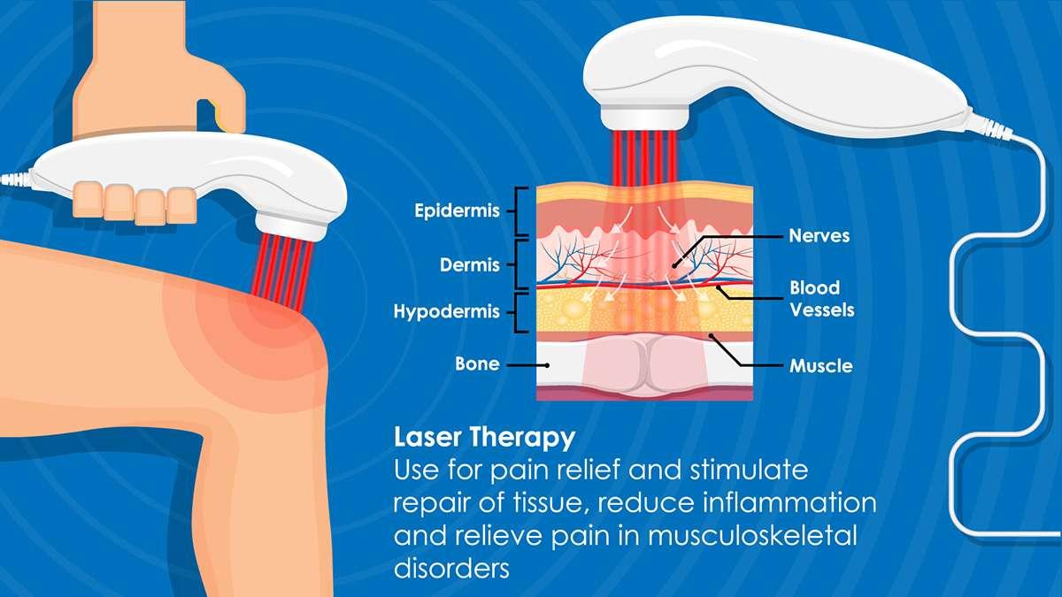 Navigating Common Concerns: Typical Side Effects of Laser Therapy