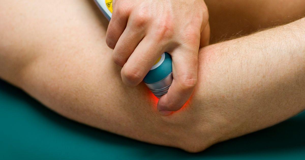 Freezing the Misconceptions: Alternatives to Cold Laser Therapy