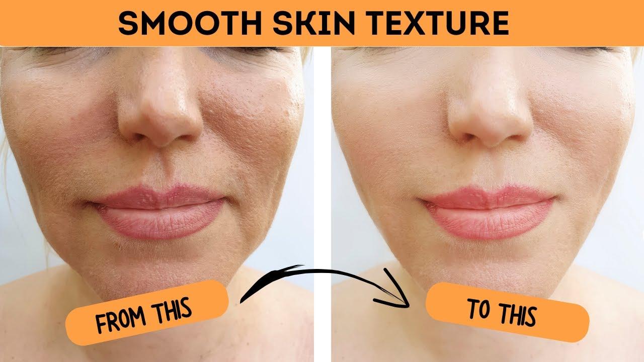 Skin Smoothness: Post-Treatment Care and Tips