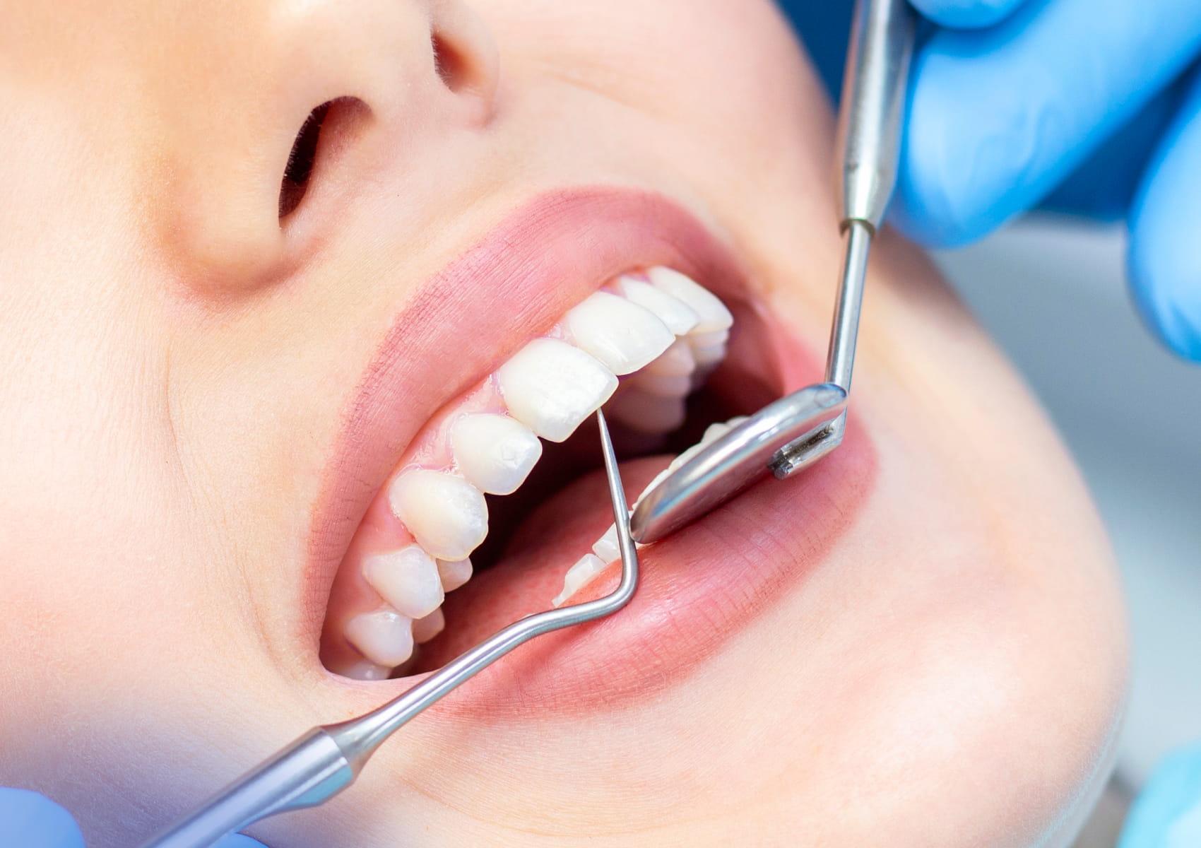A Walk Down Dental Aisle: Traditional vs. Er:YAG Laser Treatments