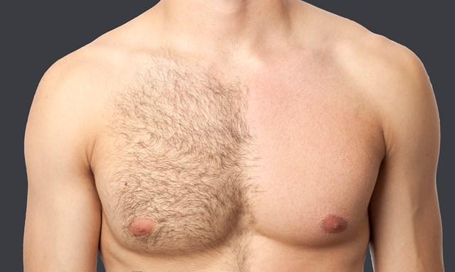 Understanding Nipple Hairs: Causes and Myths Debunked