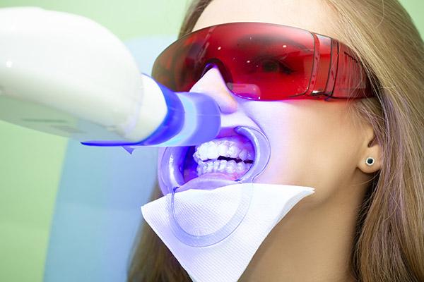 How Laser ​Whitening ​Works: The Science Behind‍ the Glow