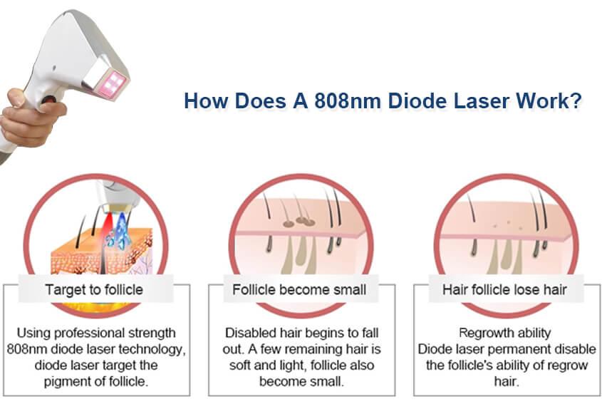 Bask in Smoothness: The Science Behind Diode Laser Technology