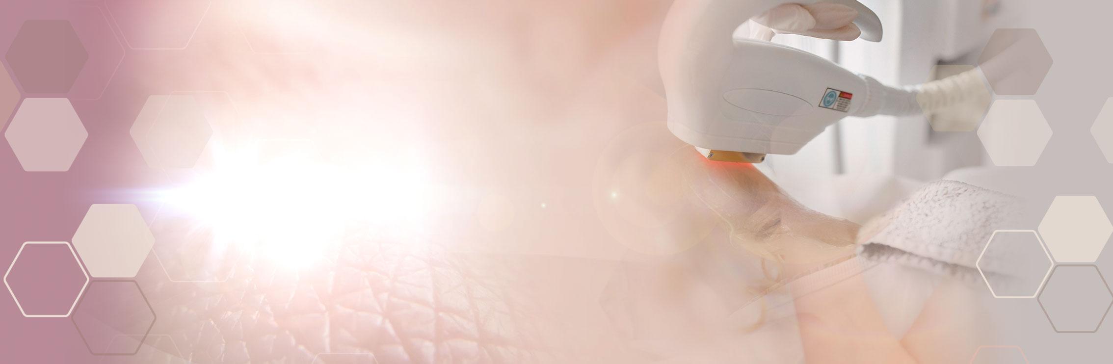 Say Goodbye to Unwanted Hair with SHR at Affinity! 4 Gentle Yet Effective: The Benefits of SHR Technology