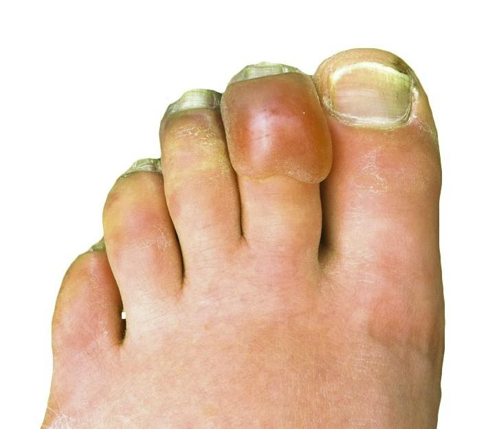 From ⁢Frosty to Frostbite:​ Safety Concerns You⁢ Shouldn’t Ignore