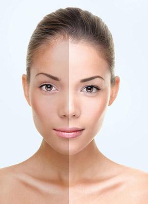 Unveil the Glow: Enhancing Skin Radiance with Laser Treatments