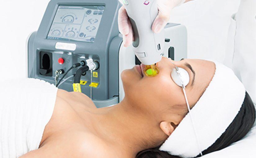 Types of Laser Machines: Which One is Right for You?