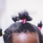 Photo Hair regrowth
