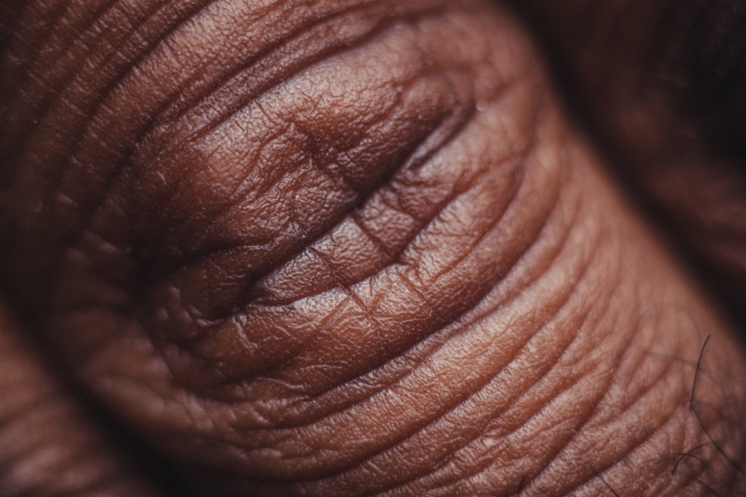 Photo Moisturized skin