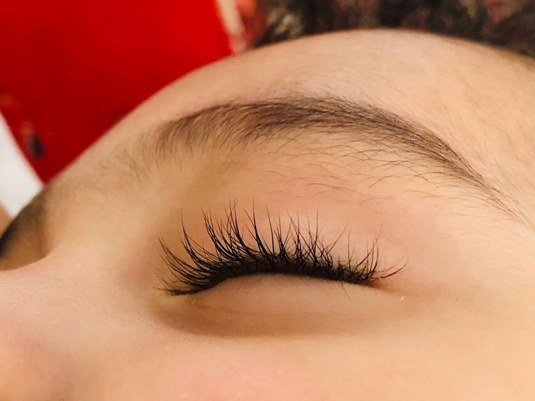 Photo Laser hair removal
