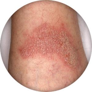 Exploring Possible Long-Term Skin‌ Changes